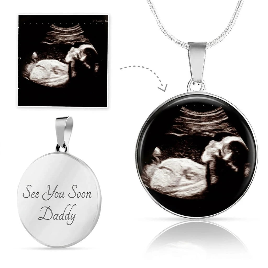 Personalized Photo Engraved Baby Ultrasound Sonogram Surgical Steel Circle Pendant Necklace